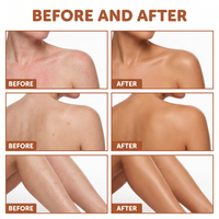 Before and after coverage of ordinary redness and uneven skin tone on shoulders, back and legs using NUELLE Body Perfector