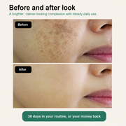 Clarune before and after look, a brighter calmer looking complexion with steady daily use
